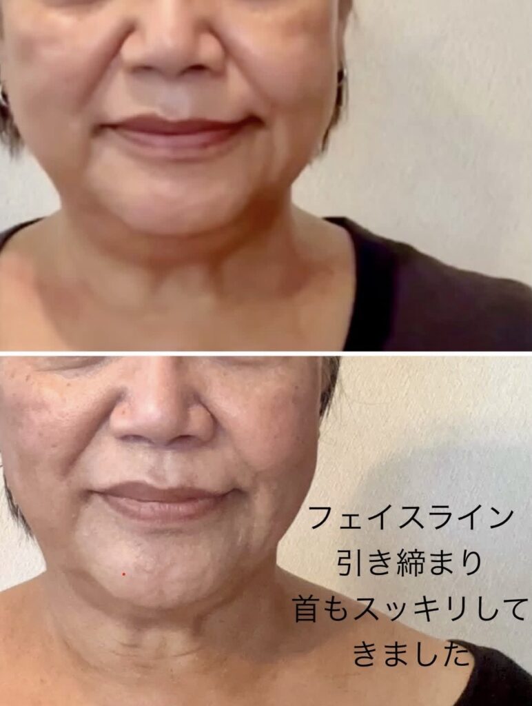 すっきりしたフェイスラインと首元
